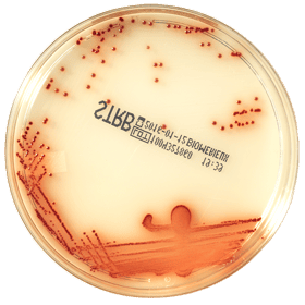 Товар: Хромогенный селективный агар для выделения Strep B, готовый, в чашках Петри